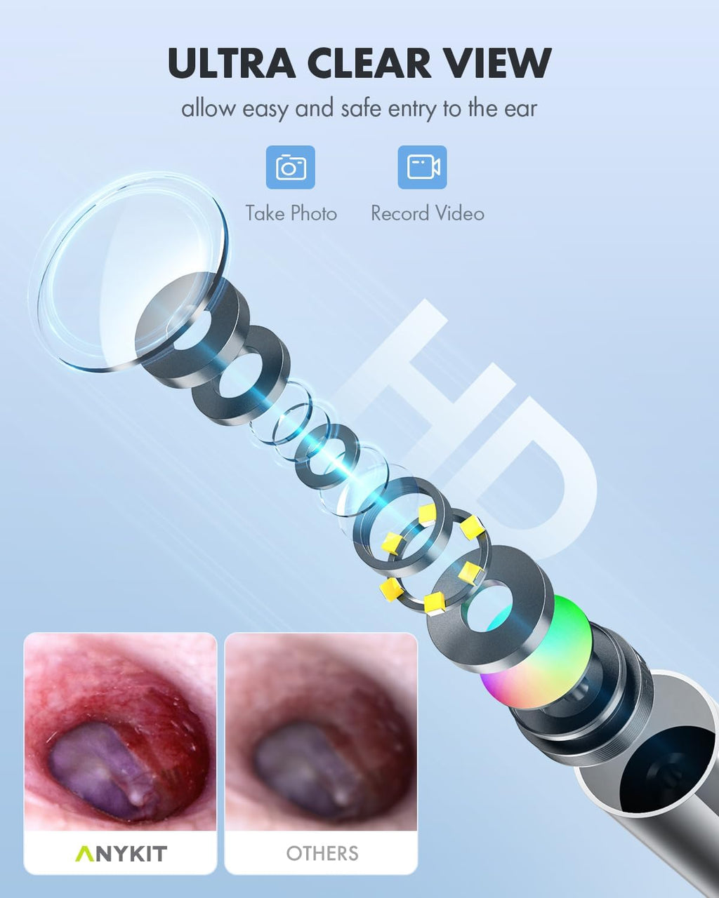 HD Ultra Clear View Ear Wax Removal Tool Otoscope with Ear Spoon H2310
